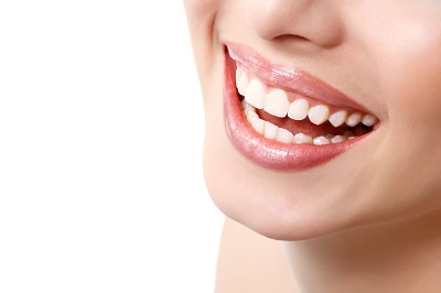 A wide smile of young woman with a great healthy white teeth