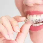 A smiling woman holding invisalign
